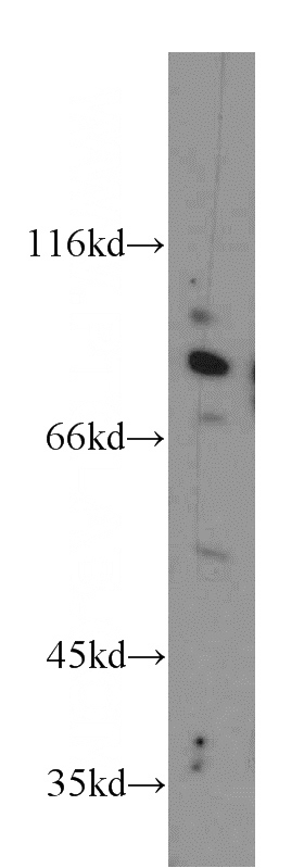 HeLa cells were subjected to SDS PAGE followed by western blot with Catalog No:109742(CUL2 antibody) at dilution of 1:100