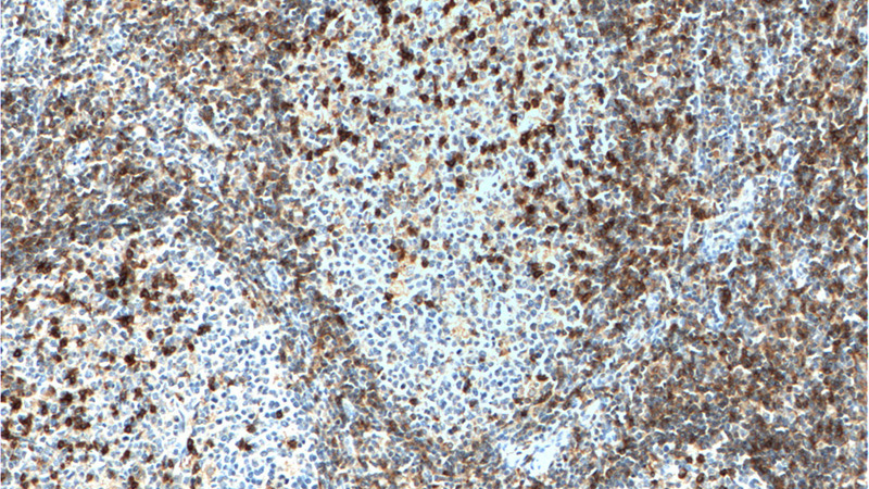 Immunohistochemistry of paraffin-embedded human tonsillitis tissue slide using Catalog No:109135(CD69 Antibody) at dilution of 1:200 (under 10x lens). heat mediated antigen retrieved with Tris-EDTA buffer(pH9).