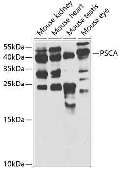 Western blot - PSCA Polyclonal Antibody 
