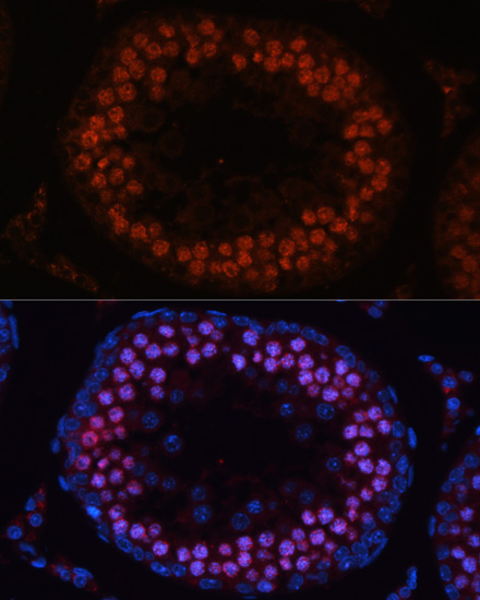 Immunofluorescence - MSH4 Polyclonal Antibody 