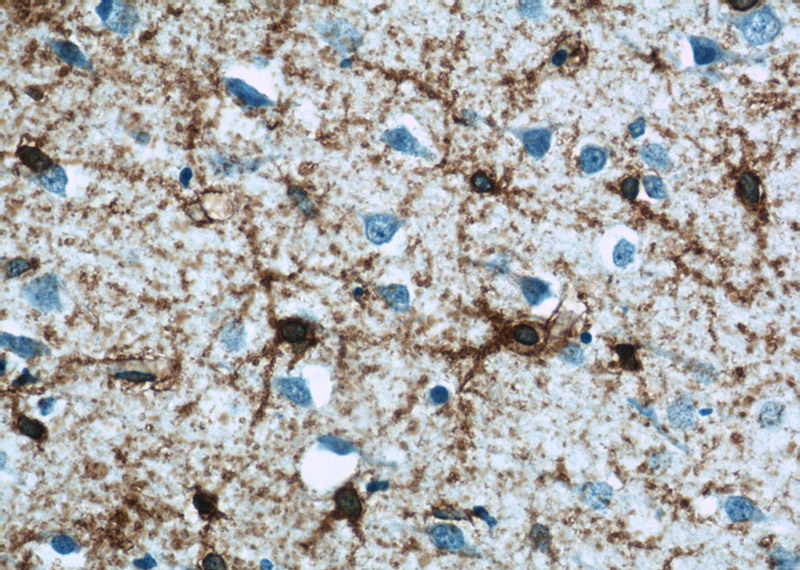 Immunohistochemistry of paraffin-embedded human brain tissue slide using Catalog No:111019(SLC1A3 Antibody) at dilution of 1:50 (under 40x lens)