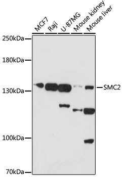 Western blot - SMC2 Polyclonal Antibody 