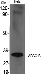 Fig1:; Western Blot analysis of various cells using ABCC13 Polyclonal Antibody cells nucleus extracted by Minute TM Cytoplasmic and Nuclear Fractionation kit (SC-003,Inventbiotech,MN,USA).