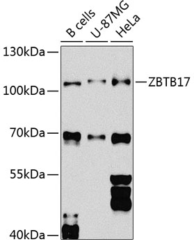 Western blot - ZBTB17 Polyclonal Antibody 