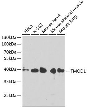 Western blot - TMOD1 Polyclonal Antibody 