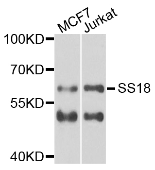 Western blot - SS18 Polyclonal Antibody 