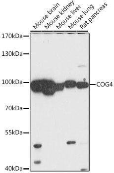 Western blot - COG4 Polyclonal Antibody 