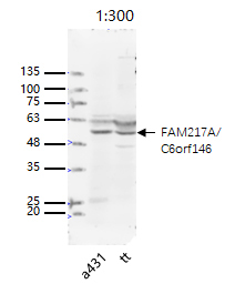 Fig1: Sample:; TT(Human) Cell Lysate at 40 ug; Primary: Anti-phospho-IFNGR1 (Tyr457) at 1/300 dilution; Secondary: IRDye800CW Goat Anti-Rabbit IgG at 1/20000 dilution; Predicted band size: 53 kD; Observed band size: 53 kD