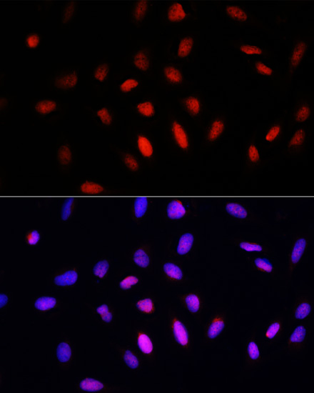 Immunofluorescence - COMMD1 Polyclonal Antibody 
