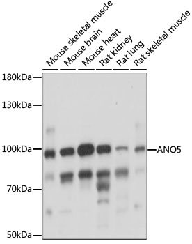 Western blot - ANO5 Polyclonal Antibody 