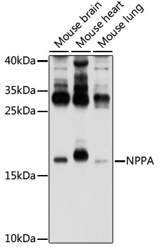 Western blot - NPPA Polyclonal Antibody 