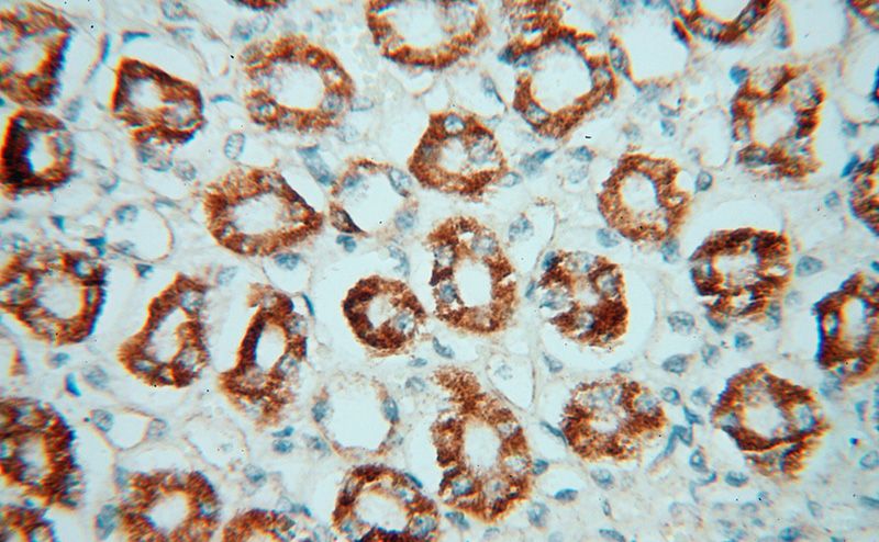 Immunohistochemical of paraffin-embedded human kidney using Catalog No:111522(HOOK3 antibody) at dilution of 1:100 (under 40x lens)