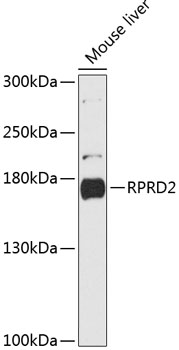Western blot - RPRD2 Polyclonal Antibody 