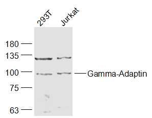 Fig5: Sample:; 293T(Human) Cell Lysate at 30 ug; Jurkat(Human) Cell Lysate at 30 ug; Primary: Anti-Gamma-Adaptin at 1/1000 dilution; Secondary: IRDye800CW Goat Anti-Rabbit IgG at 1/20000 dilution; Predicted band size: 91 kD; Observed band size: 91 kD