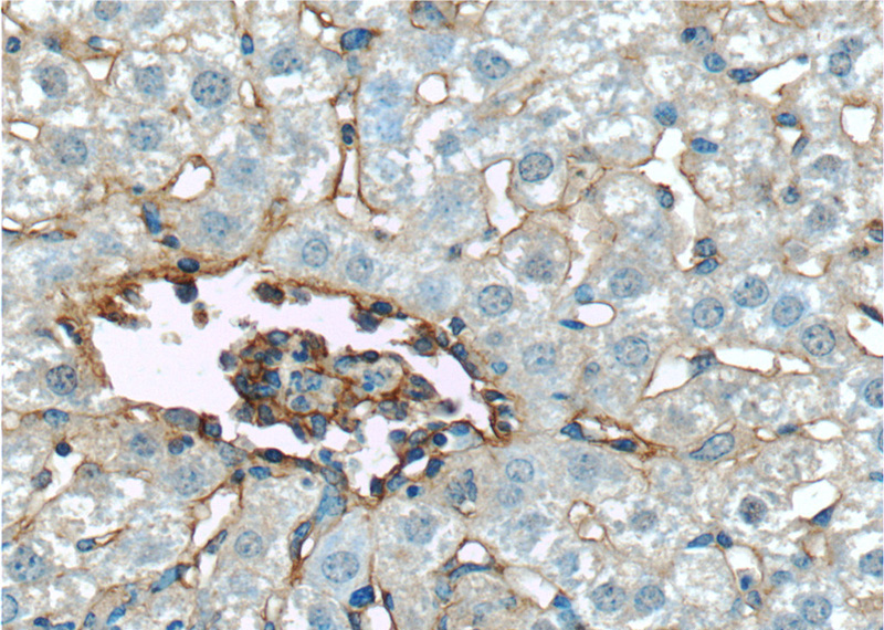 Immunohistochemistry of paraffin-embedded mouse liver tissue slide using Catalog No:111586(Icam1 Antibody) at dilution of 1:200 (under 40x lens)