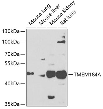 Western blot - TMEM184A Polyclonal Antibody 