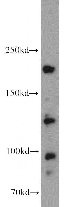 HEK-293 cells were subjected to SDS PAGE followed by western blot with Catalog No:108953(CC2D2A antibody) at dilution of 1:500