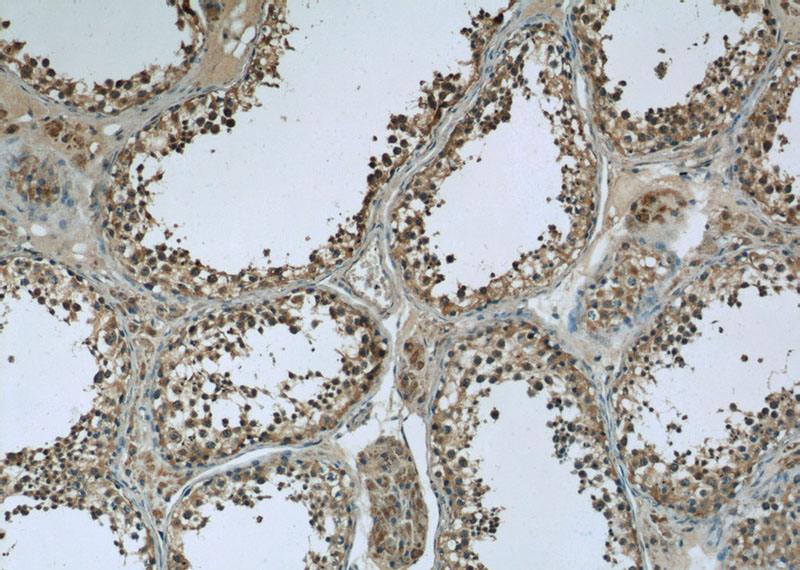 Immunohistochemistry of paraffin-embedded human testis slide using Catalog No:115994(C1orf223 Antibody) at dilution of 1:50 (under 10x lens)