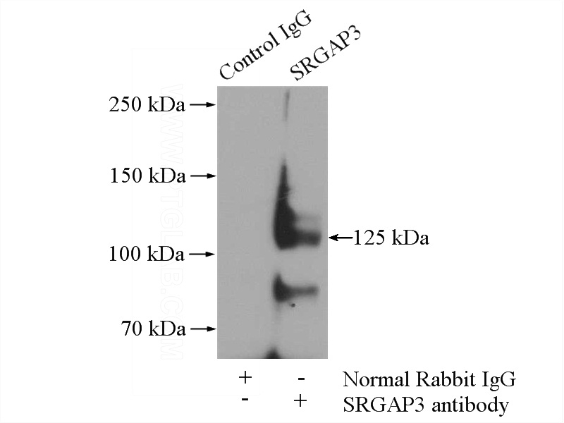 IP Result of anti-SRGAP3-Specific (IP:Catalog No:115588, 4ug; Detection:Catalog No:115588 1:800) with mouse kidney tissue lysate 4000ug.