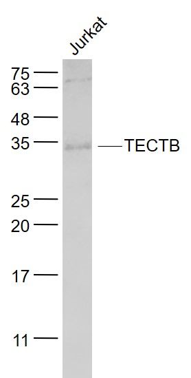 Fig1: Sample:; Jurkat(Human) Cell Lysate at 30 ug; Primary: Anti- TECTB at 1/1000 dilution; Secondary: IRDye800CW Goat Anti-Rabbit IgG at 1/20000 dilution; Predicted band size: 32 kD; Observed band size: 32 kD