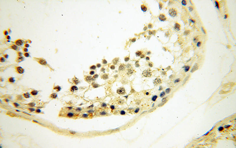 Immunohistochemical of paraffin-embedded human testis using Catalog No:109776(DDR1 antibody) at dilution of 1:50 (under 40x lens)