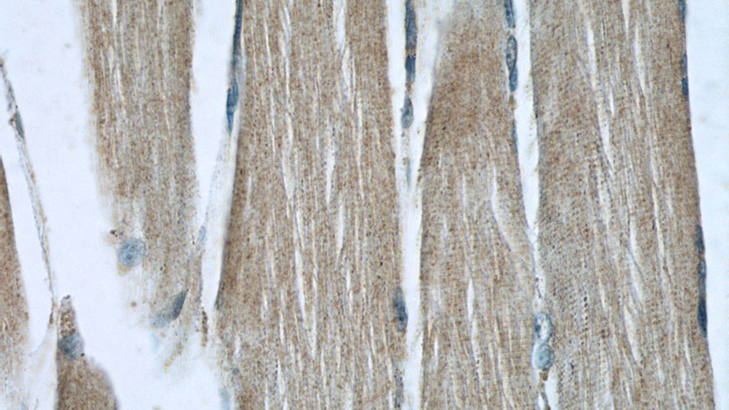 Immunohistochemistry of paraffin-embedded human skeletal muscle slide using Catalog No:108664(C14orf39 Antibody) at dilution of 1:50