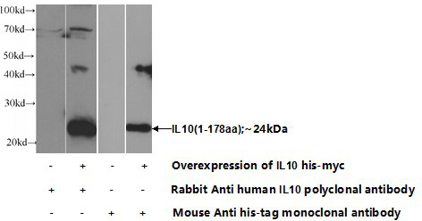 Transfected HEK-293 cells were subjected to SDS PAGE followed by western blot with Catalog No:111654(IL10 Antibody) at dilution of 1:1000