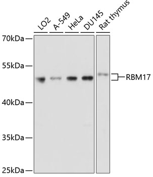 Western blot - RBM17 Polyclonal Antibody 