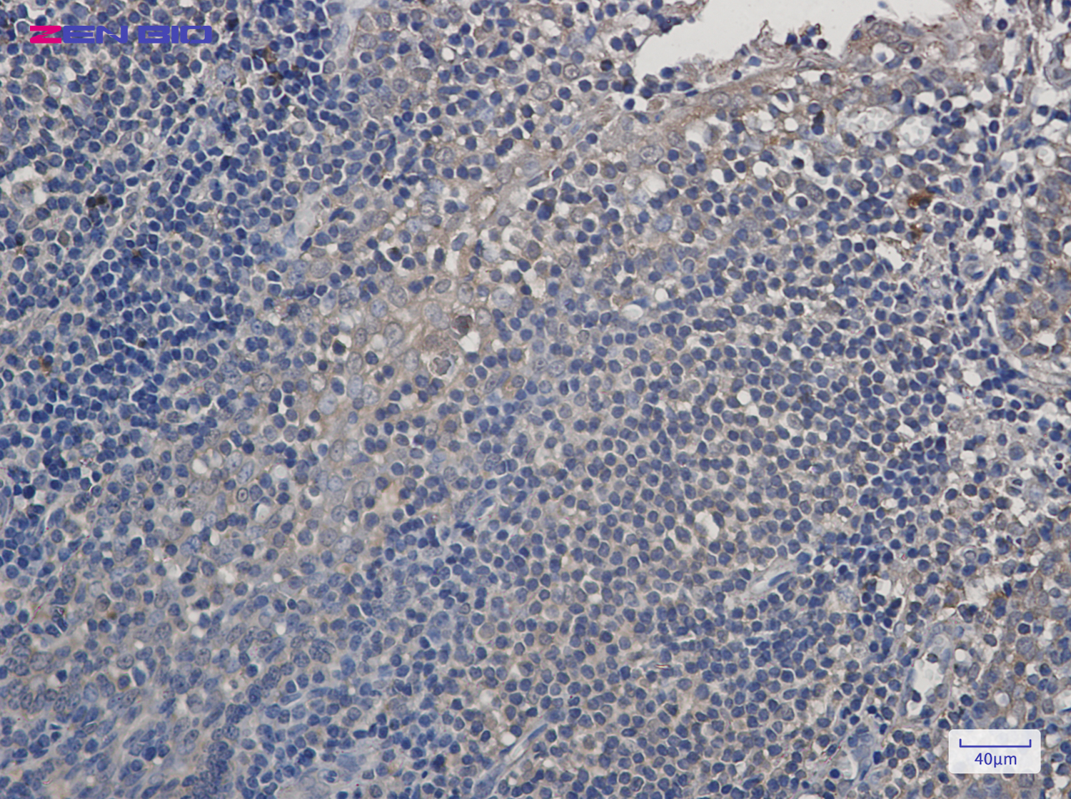 Immunohistochemistry of PSMA4 in paraffin-embedded Human tonsil using PSMA4 Rabbit pAb at dilution 1/50
