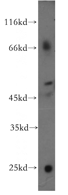 HepG2 cells were subjected to SDS PAGE followed by western blot with Catalog No:109594(CSF2RA antibody) at dilution of 1:600