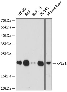 Western blot - RPL21 Polyclonal Antibody 