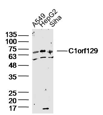 Fig1: Sample:; A549 Cell (Human) Lysate at 30 ug; HepG2 Cell (Human) Lysate at 30 ug; Siha Cell (Human) Lysate at 30 ug; Primary: Anti-C1orf129 at 1/300 dilution; Secondary: IRDye800CW Goat Anti-Rabbit IgG at 1/20000 dilution; Predicted band size: 65kD; Observed band size: 65kD