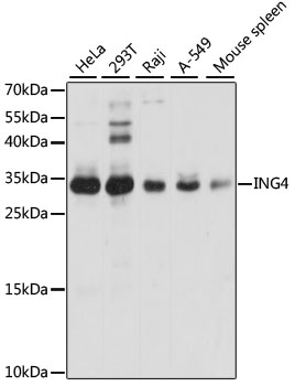 Western blot - ING4 Polyclonal Antibody 