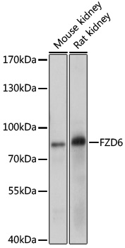 Western blot - FZD6 Polyclonal Antibody 