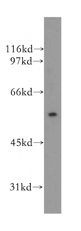 Jurkat cells were subjected to SDS PAGE followed by western blot with Catalog No:116299(TRIM15 antibody) at dilution of 1:500