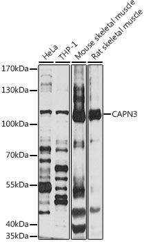 Western blot - CAPN3 Polyclonal Antibody 