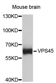 Western blot - VPS45 Polyclonal Antibody 