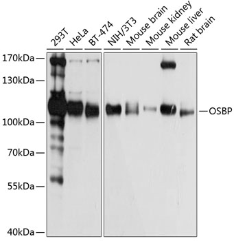 Western blot - OSBP Polyclonal Antibody 