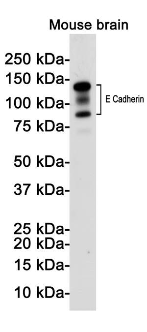 Western blot detection of E Cadherin in Mouse brain lysates using E Cadherin Rabbit pAb(1:1000 diluted).Predicted band size:98(cleavages),135KDa.Observed band size: 80-120(cleavages),135KDa.