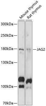 Western blot - JAG2 Polyclonal Antibody 