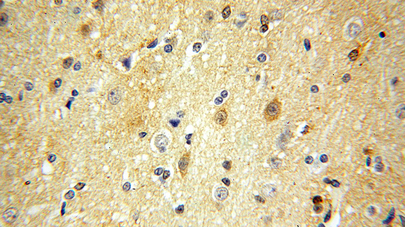 Immunohistochemical of paraffin-embedded human brain using Catalog No:113775(PGAM1 antibody) at dilution of 1:50 (under 40x lens)