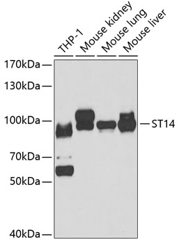 Western blot - ST14 Polyclonal Antibody 