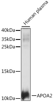 Western blot - APOA2 Polyclonal Antibody 