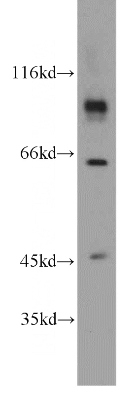 human brain tissue were subjected to SDS PAGE followed by western blot with Catalog No:109274(CHPF antibody) at dilution of 1:800