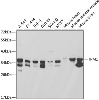 Western blot - TPM1 Polyclonal Antibody 