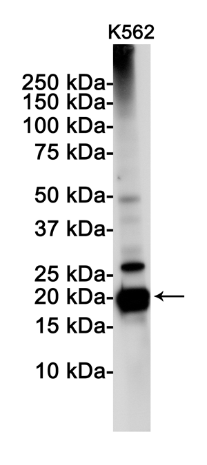 Western blot detection of PUMA in K562 cell lysates using PUMA Rabbit pAb(1:1000 diluted).Predicted band size:21KDa.Observed band size:21KDa.