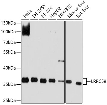 Western blot - LRRC59 Polyclonal Antibody 
