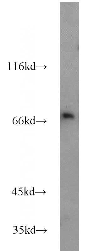 mouse liver tissue were subjected to SDS PAGE followed by western blot with Catalog No:115806(SYTL3 antibody) at dilution of 1:500
