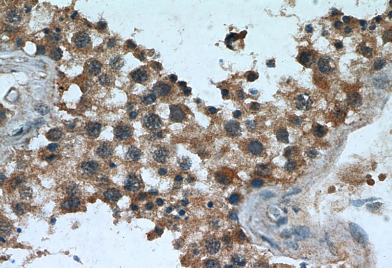 Immunohistochemical of paraffin-embedded human testis using Catalog No:107634(TPP2 antibody) at dilution of 1:50 (under 40x lens)
