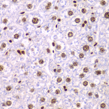 Immunohistochemistry - SSRP1 Polyclonal Antibody 